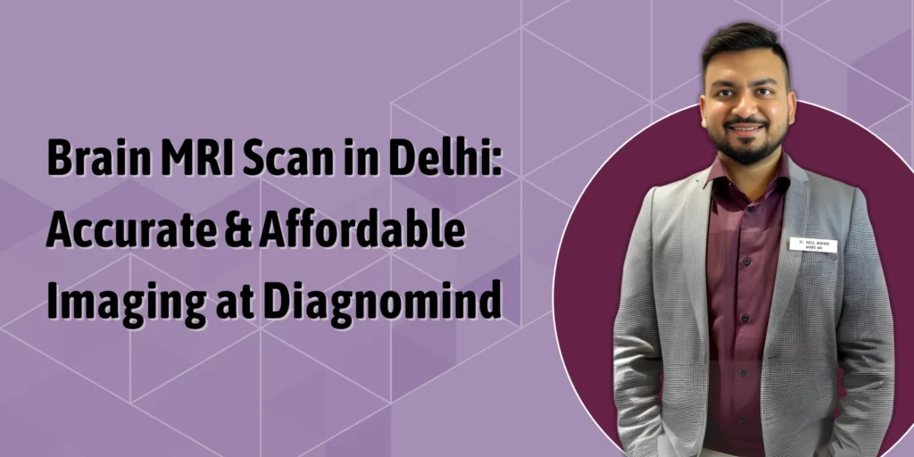 brain MRI scan Delhi